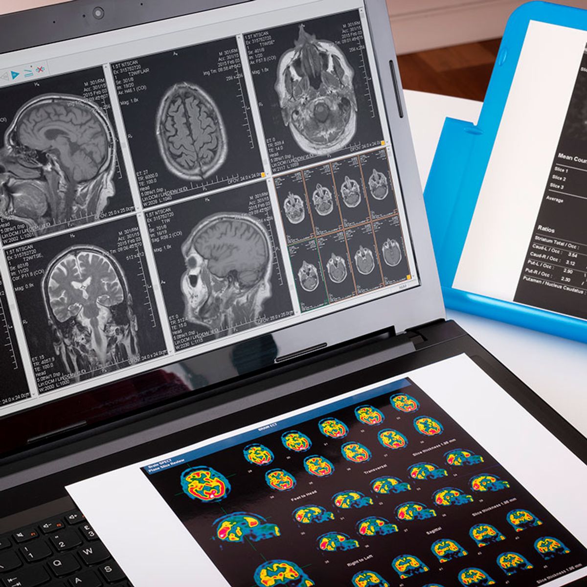 Doble Máster Universitario en Psicología General Sanitaria y Neuropsicología