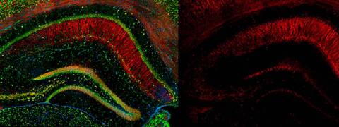 La imagen muestra secciones cerebrales con diferentes colores que representan distintas estructuras neuronales.
